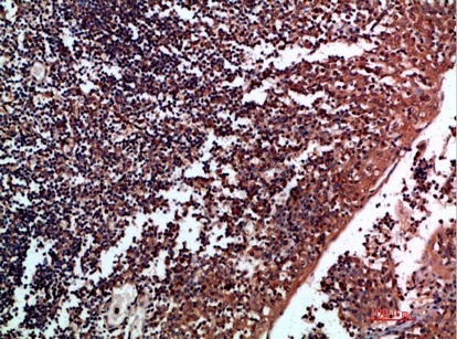 Fig.1. Immunohistochemical analysis of paraffin-embedded human-tonsil, antibody was diluted at 1:200.