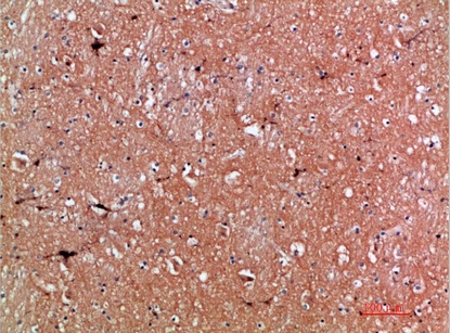 Fig.2. Immunohistochemical analysis of paraffin-embedded human-brain, antibody was diluted at 1:200.