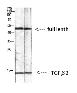 Fig.1. Western blot analysis of Mouse-kidney 293T Mouse-lung lysate, antibody was diluted at 1:1000. HRP, Goat Anti-Rabbit IgG (Cat #: A21020) secondary antibody was diluted at 1:20000.