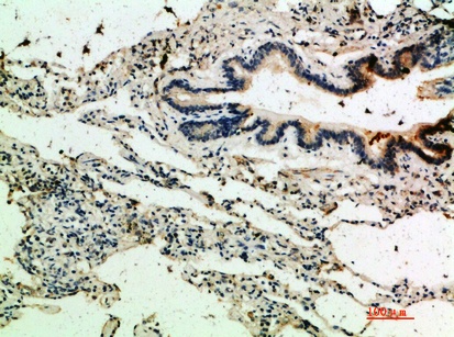 Fig.1. Immunohistochemical analysis of paraffin-embedded human-lung, antibody was diluted at 1:200.