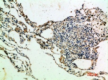 Fig.2. Immunohistochemical analysis of paraffin-embedded human-lung, antibody was diluted at 1:200.
