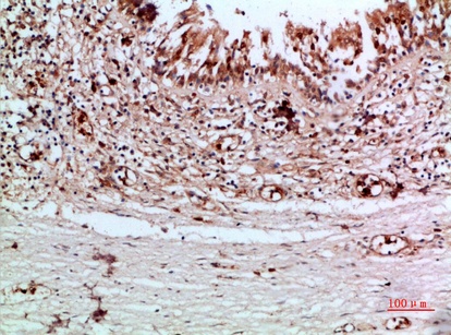 Fig.1. Immunohistochemical analysis of paraffin-embedded human-thyroid, antibody was diluted at 1:200.