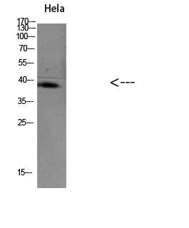 Fig.1. Western blot analysis of KB Hela 293T Mouse-brain lysate, antibody was diluted at 1:1000. HRP, Goat Anti-Rabbit IgG (Cat #: A21020) secondary antibody was diluted at 1:20000.