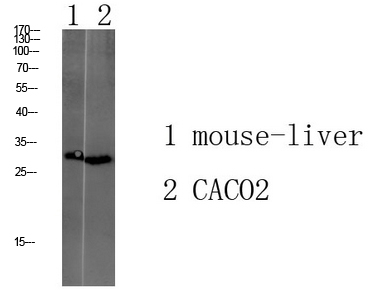 Fig.1. Western blot analysis of various lysate, antibody was diluted at 1:1000. HRP, Goat Anti-Rabbit IgG (Cat #: A21020) secondary antibody was diluted at 1:20000.