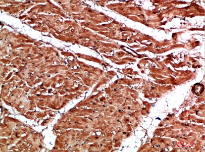 Fig.1. Immunohistochemical analysis of paraffin-embedded human-heart, antibody was diluted at 1:200.