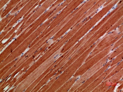 Fig.3. Immunohistochemical analysis of paraffin-embedded human-skeletal-muscle, antibody was diluted at 1:200.
