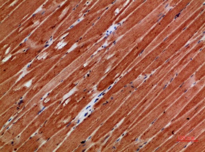Fig.4. Immunohistochemical analysis of paraffin-embedded human-skeletal-muscle, antibody was diluted at 1:200.