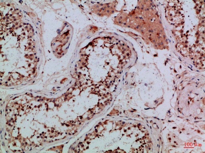 Fig.2. Immunohistochemical analysis of paraffin-embedded Human-testis, antibody was diluted at 1:100.