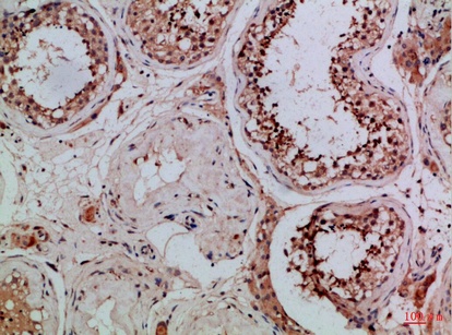 Fig.3. Immunohistochemical analysis of paraffin-embedded Human-testis, antibody was diluted at 1:100.