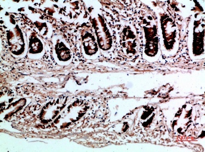Fig.2. Immunohistochemical analysis of paraffin-embedded human-colon, antibody was diluted at 1:200.