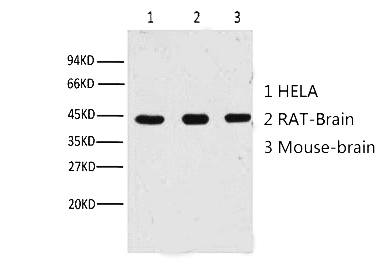 Fig. Western blot analysis of Hela (1) , Rat brain (2) , Mouse brain (3) ,(A02) diluted at 1:10000.