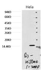 Fig. Western blot analysis of hela, diluted at 1:2000.