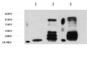 Fig. Western blot analysis of 1) Hela, 2) Rat Testis tissue, 3) Raw264.7, diluted at 1:2000.