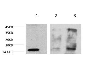 Fig. Western blot analysis of 1) Hela, 2) Rat Testis tissue, 3) Raw264.7, diluted at 1:1000.