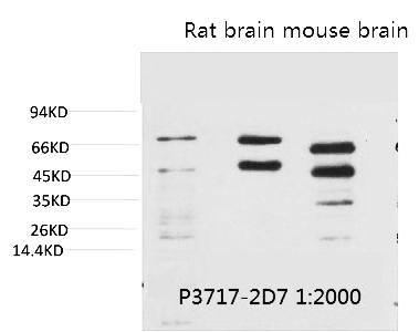 Fig.1. Western blot analysis of 1) Hela, 2) Rat Brain Tissue, 3) Mouse Brain Tissue with Phosphoserine Mouse mAb diluted at 1:2000.