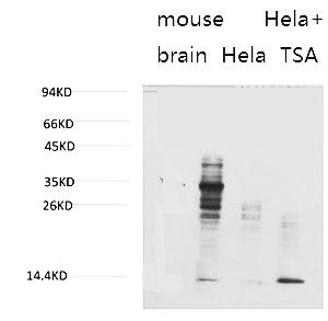 Fig.1. Western blot analysis of 1) Mouse Brain Tissue, 2) Hela, 3) Hela+TSA Treated using Acetyl Lysine Monoclonal Antibody.