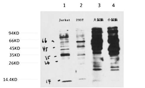 Fig.1. Western blot analysis of 1) Jurkat, 2) 293T, 3) Rat Brain Tissue, 4) Mouse Brain Tissue with Phosphotyrosine Mouse mAb diluted at 1:2000.