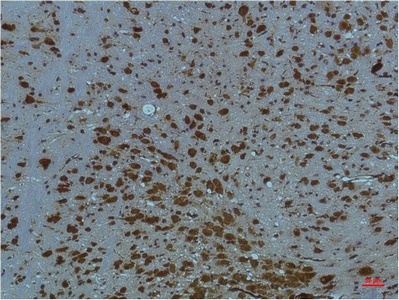 Fig.3. Immunohistochemical analysis of paraffin-embedded Mouse BrainTissue using PI3 Kinase P85 α Mouse mAb diluted at 1:200.