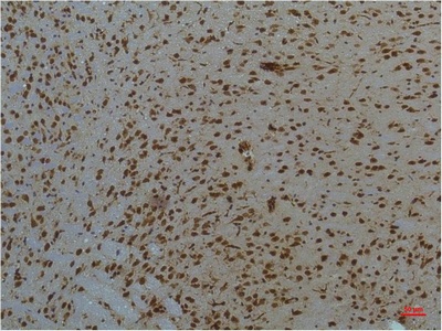 Fig.3. Immunohistochemical analysis of paraffin-embedded Mouse Brain Tissue using STAT3Mouse mAb diluted at 1:200.