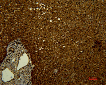 Fig.2. Immunohistochemical analysis of paraffin-embedded human-liver using antibody diluted at 1:50.