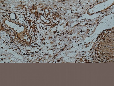 Fig.2. Immunohistochemical analysis of paraffin-embedded human-colon using antibody diluted at 1:50.