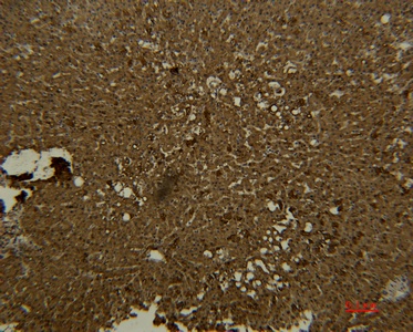 Fig.1. Immunohistochemical analysis of paraffin-embedded human-liver using antibody diluted at 1:50.