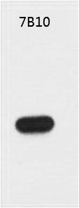 Fig. Western blot analysis of Recombinant S1-Tag Protein with S1-Tag Mouse mAb diluted at 1:5000.
.
