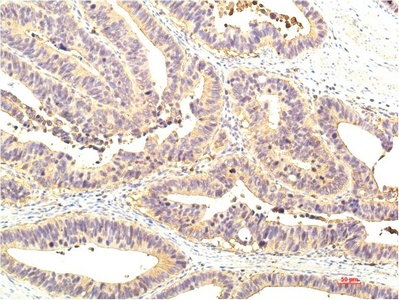 Fig.1. Immunohistochemical analysis of paraffin-embedded Human Colon Tissue using STAT1 Mouse mAb diluted at 1:200.