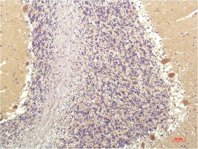 Fig.1. Immunohistochemical analysis of paraffin-embedded Human Brain Tissue using SGK1 Mouse mAb diluted at 1:200.