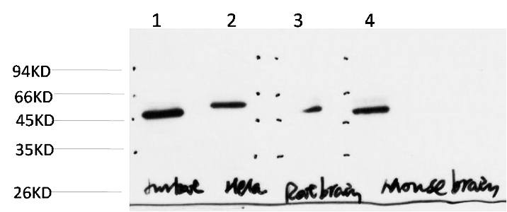 Fig.3. Western Blot analysis of paraffin-embedded JurkatHelaMouse-brainRat-brain using Gamma Tubulin Mouse mAb diluted at 1:1000.