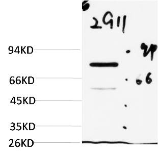 Fig. Western blot analysis of Firefly Luciferase Transfected Hela Cell Lysate using Luciferase Mouse mAb diluted at 1:2000.