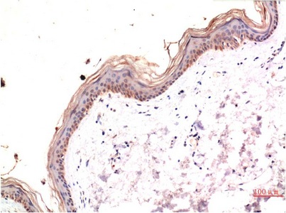 Fig.2. Immunohistochemical analysis of paraffin-embedded Human Skin Tissue using Phospho-MLKL S358 Mouse mAb diluted at 1:200.