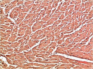 Fig.2. Immunohistochemical analysis of paraffin-embedded Human Heart Tissue using VE-Cadherin Mouse mAb diluted at 1:200.
