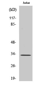 Fig. Western Blot analysis of various cells using Cleaved-Cathepsin A 32k (R326) Polyclonal Antibody.