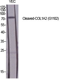 Fig.1. Western Blot analysis of various cells using Cleaved-COL1A2 (G1102) Polyclonal Antibody diluted at 1:1000.