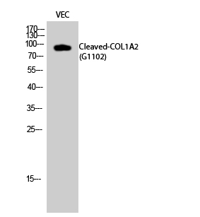Fig.2. Western Blot analysis of VEC cells using Cleaved-COL1A2 (G1102) Polyclonal Antibody diluted at 1:1000.