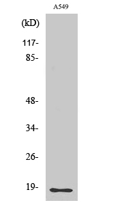 Fig. Western Blot analysis of various cells using Cleaved-MMP-1 22k (F100) Polyclonal Antibody.