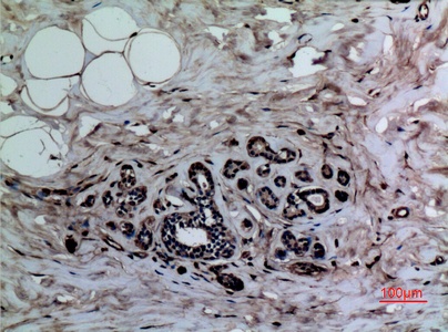 Fig.2. Immunohistochemical analysis of paraffin-embedded human-breast, antibody was diluted at 1:100.