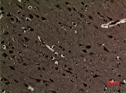 Fig.2. Immunohistochemical analysis of paraffin-embedded human-brain, antibody was diluted at 1:100.