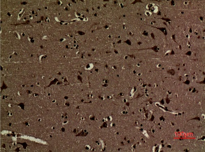 Fig.3. Immunohistochemical analysis of paraffin-embedded human-brain, antibody was diluted at 1:100.