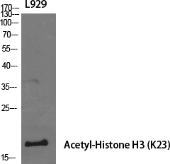 Fig.1. Western Blot analysis of various cells using Acetyl-Histone H3 (K23) Polyclonal Antibody diluted at 1:1000. Secondary antibody (catalog#: A21020) was diluted at 1:20000.