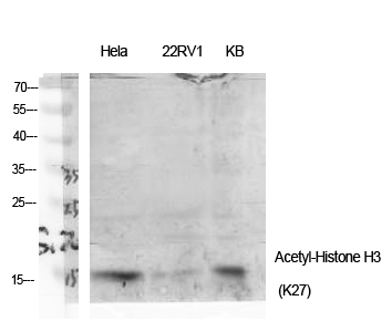 Fig.1. Western Blot analysis of various cells using Acetyl-Histone H3 (K27) Polyclonal Antibody diluted at 1:2000. Secondary antibody (catalog#: A21020) was diluted at 1:20000.