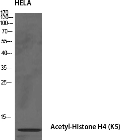 Fig.1. Western Blot analysis of various cells using Acetyl-Histone H4 (K5) Polyclonal Antibody diluted at 1:1000. Secondary antibody (catalog#: A21020) was diluted at 1:20000.