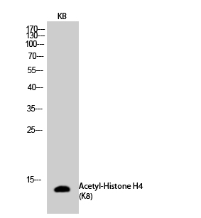 Fig.2. Western Blot analysis of KB cells using Acetyl-Histone H4 (K8) Polyclonal Antibody diluted at 1:500. Secondary antibody (catalog#: A21020) was diluted at 1:20000.