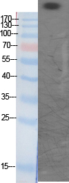 Fig. Western Blot analysis of various cells using Acetyl-CBP (K1535) Polyclonal Antibody diluted at 1:1000. Secondary Antibody  was diluted at 1:20000.