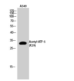 Fig.2. Western Blot analysis of A549 cells using Acetyl-ATF-5 (K29) Polyclonal Antibody. Secondary Antibody  was diluted at 1:20000.
