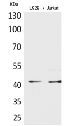 Fig.1. Western Blot analysis of L929, Jurkat cells using Acetyl-E2F-4 (K96) Polyclonal Antibody. Secondary Antibody was diluted at 1:20000.