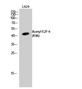 Fig.2. Western Blot analysis of L929 cells using Acetyl-E2F-4 (K96) Polyclonal Antibody. Secondary Antibody was diluted at 1:20000.