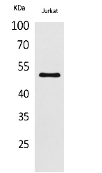 Fig.1. Western Blot analysis of Jurkat cells using Acetyl-HNF-3α/β/γ (K264/253/211) Polyclonal Antibody. Secondary Antibody was diluted at 1:2000O.