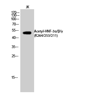 Fig.2. Western Blot analysis of JK cells using Acetyl-HNF-3α/β/γ (K264/253/211) Polyclonal Antibody. Secondary Antibody was diluted at 1:20000.
